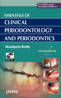 Essential of Clinical Periodontology and Periodontics