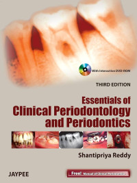Image of Essentials of Clinical Periodontology and Periodontics