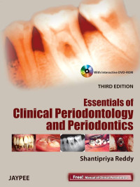 Essentials of Clinical Periodontology and Periodontics