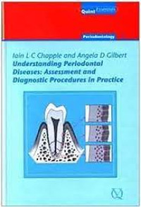 Image of Understanding Periodontal Diseases