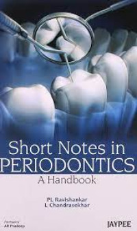 Image of A Handbook Short Notes In Periodontics