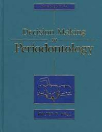 Decision Making in Periodontology
