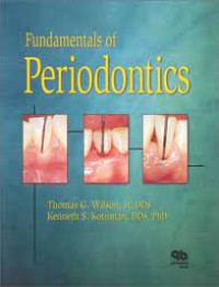 Image of Fundamentals of Periodontic