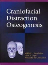 Craniofacial Distraction Osteogenesis