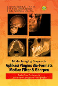 Image of Modul Imaging Diagnostik Aplikasi Plugins Bio-Formats Median Filter & Sharpen