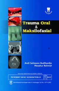 Image of Trauma Oral & Maksilofasial