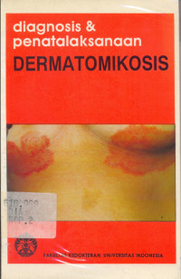 Diagnosis & Penatalaksanaan Dermatomikosi