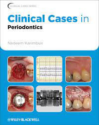 Image of Clinical Caces in Periodontics