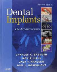 Dental Implants The Art and Science