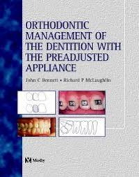Image of Orthodontic Management of the Dentition With the Preadjusted Appliance