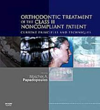 Orthodontic Treatment of The Class II Noncompliant Patient