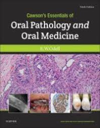 Image of Cawson's Essentials of Oral Pathology and Oral Medicine