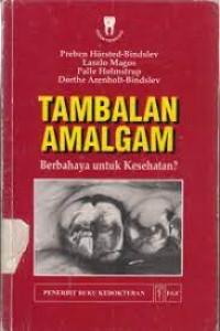 Tambalan Amalgam