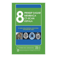 Image of 8 Prinsip Dasar Membaca CT-Scan Kepala