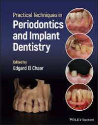 Image of Practical Techniques in Periodontics and Implant Dentistry