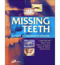 Missing Teeth a Guide to Treatment Options