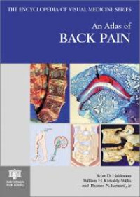 Image of The Encyclopedia of Visual Medicine Series An Atlas of Back Pain