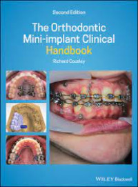 Image of The Orthodontic Mini-Implant Clinical Handbook