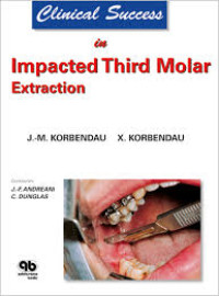 Clinical Success In Implacted Third Molar Extraction