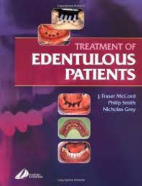Image of Treatmen of Edentulous Patients