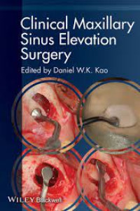 Image of Clinical Maxillary Sinus Elevation Surgery