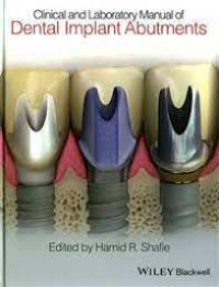 Image of Clinical and Laboratory Manual of Dental Implant Abutments