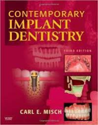 Image of Contemporary Implant Dentistry