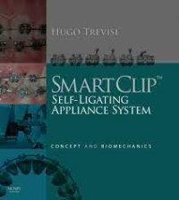 SmartClip Self-Ligating Appliance System