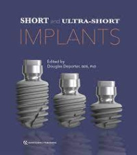 Image of Short and Ultra-Short Implants