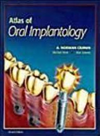 Image of Atlas of Oral Implantology, 2nd. Edition