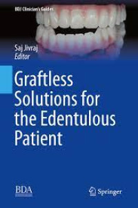Image of Graftless Solutions for the Edentulous Patient