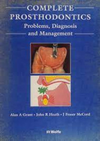 Complete Prosthodontics Problems, Diagnosis and Management