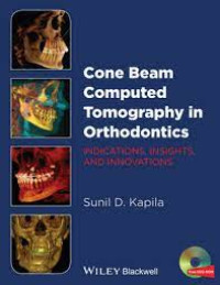 Cone Beam Computed Tomography in Orthodontics Indications, Insights and Innovations