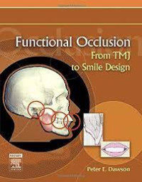 Functional Occlusion From TMJ to Smile Design