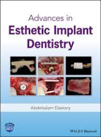 Image of Advances in Esthetic Implant Dentistry