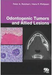 Image of Odontogenic Tumors and Allied Lesions