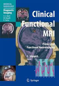 Image of Clinical Functional MRI Presurgical Functional Neuroimaging