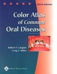 Image of Color Atlas of Common Oral Diseases