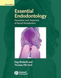 Essential Endododntology