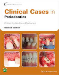 Clinical Cases in Periontics